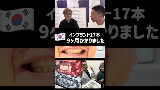 韓国で17本インプラント!9ヶ月かかりました #韓国旅行