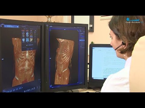 Технологии искусственного интеллекта в Центре Алмазова