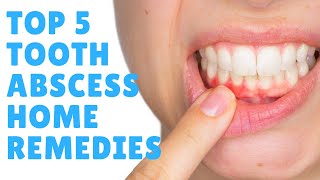 Tooth Abscess: Top 5 Tooth Abscess Home Remedies & Treatments - GET FAST RELIEF