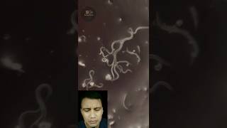 Download lagu THIS IS THE REASON KNP MUST ALWAYS WASH HANDS BEFORE EATING mp3