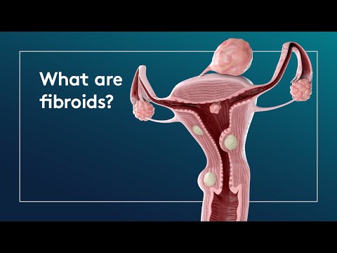 fibroids és paraziták kezelése