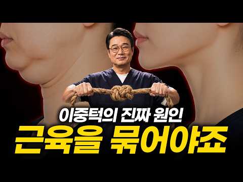 이중턱근육묶기 꼭 해야되는 사람은 따로 있습니다 | 압구정닥터정