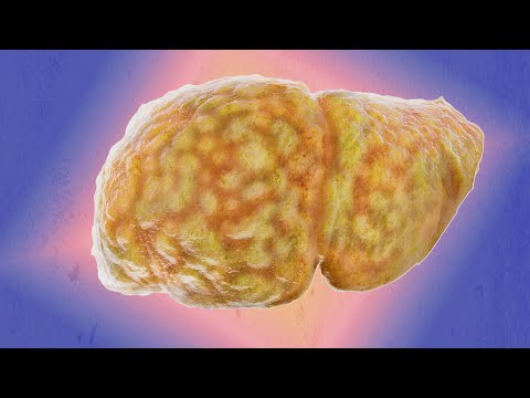 A Man Cooked Chicken In Nighttime Flu Medicine. This Is What Happened To His Liver.