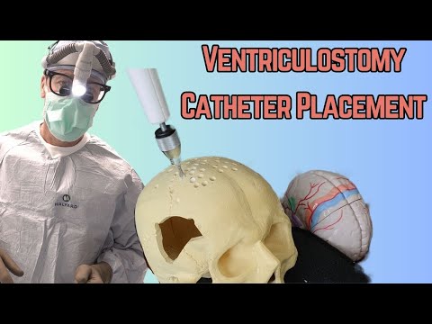 Relieving Pressure on the Brain (Neurosurgery)