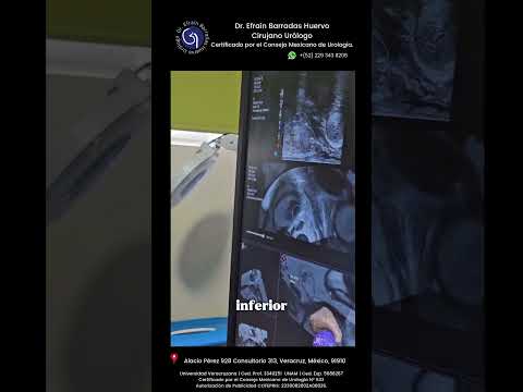 Efrain Barradas Huervo-38
