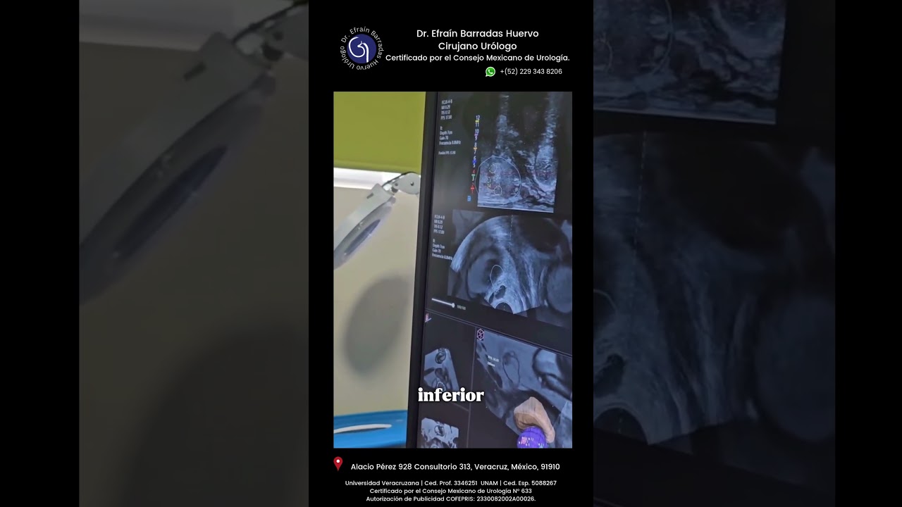 Efrain Barradas Huervo-38