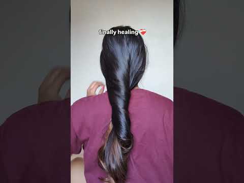 Omg this serum is a gem| wishcare hairgrowth serum #hairgrowthserum #haircareproducts #hairserum