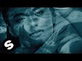 Blackcode - Scars (feat. Jess Sarubbi) [Official Lyric Video]