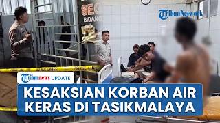 Kesaksian Korban Siraman Air Keras di Tasikmalaya Alami Luka Bakar, Pelaku Eks Pegawai Sakit Hati