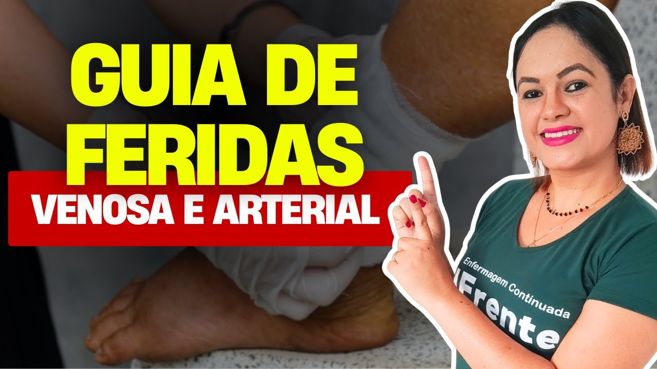 ÚLCERAS ARTERIAIS E VENOSAS (Aula completa)