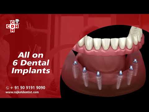 🌍 Dental Tourism in India | World-Class Dental Treatments at City Dental Hospital