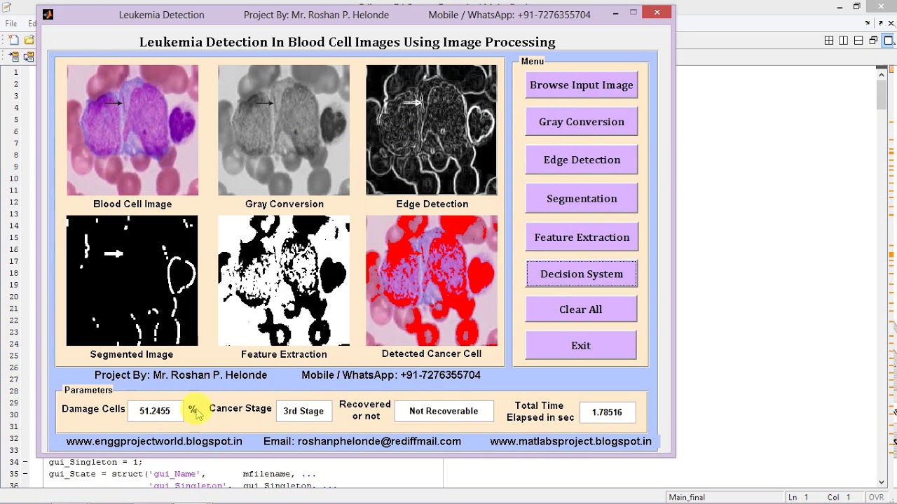 Matlab Code for Leukemia Detection Using Image Processing IEEE Based Project