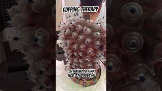 Download lagu Terapi Bekam #bekam #terapibekam #hijama #terapihijama #hijamaguy mp3 Download lagu Terapi Bekam #bekam #terapibekam #hijama #terapihijama #hijamaguy mp3