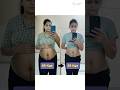 10 Kgs Belly Fat Loss Post Delivery Postpartum Journey