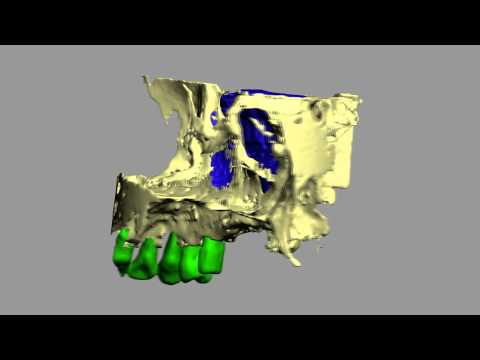 Dolore inferiore destra delladdome si estende fino alla vita e le gambe Se le vertigini con osteocondrosi cervicale