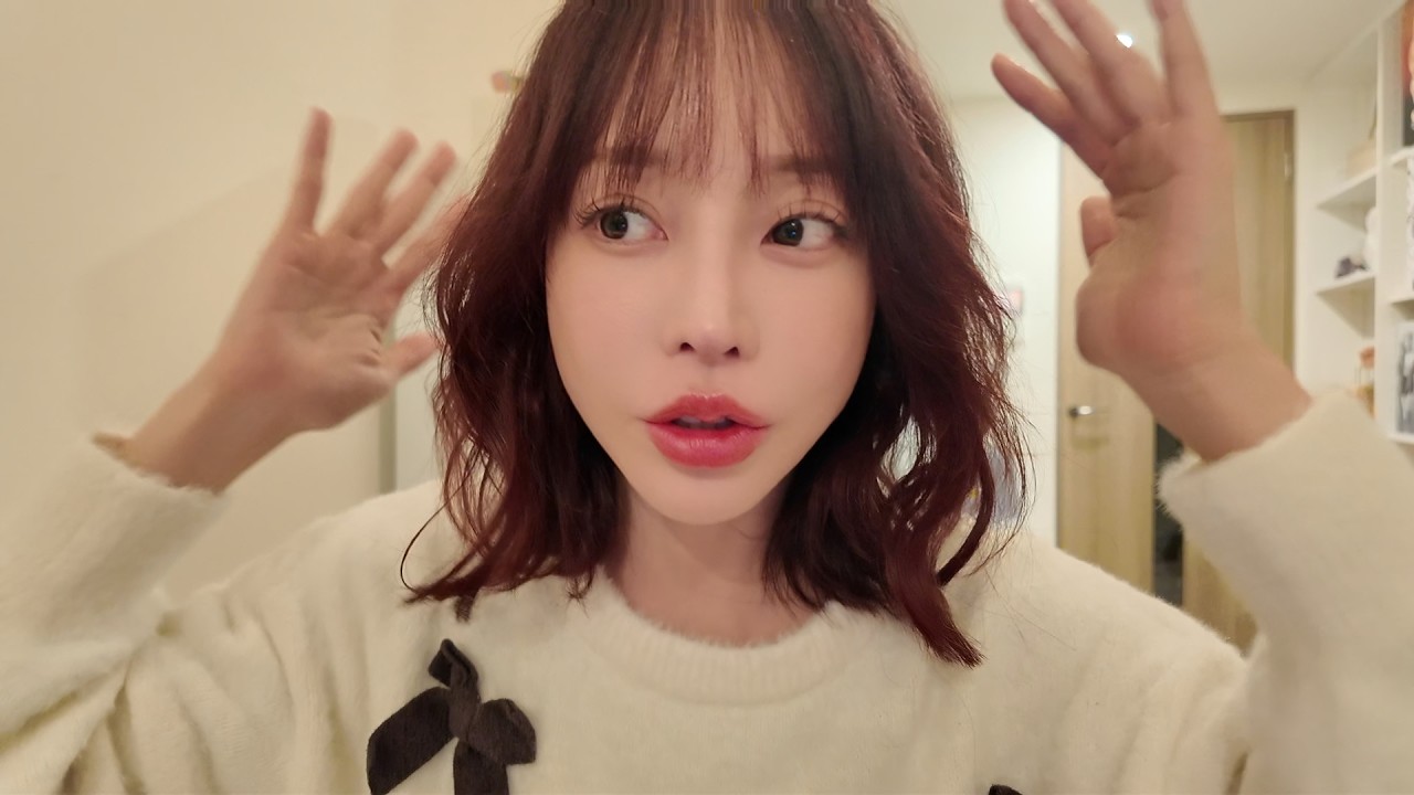 植毛しました！施術から経過全部お見せします！