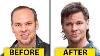 Theo Von's Hair Transplant | Plastic Surgery Analysis