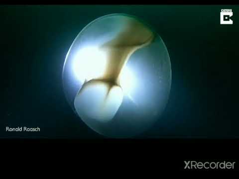 A giant Squid egg #shorts #shortvideo #short