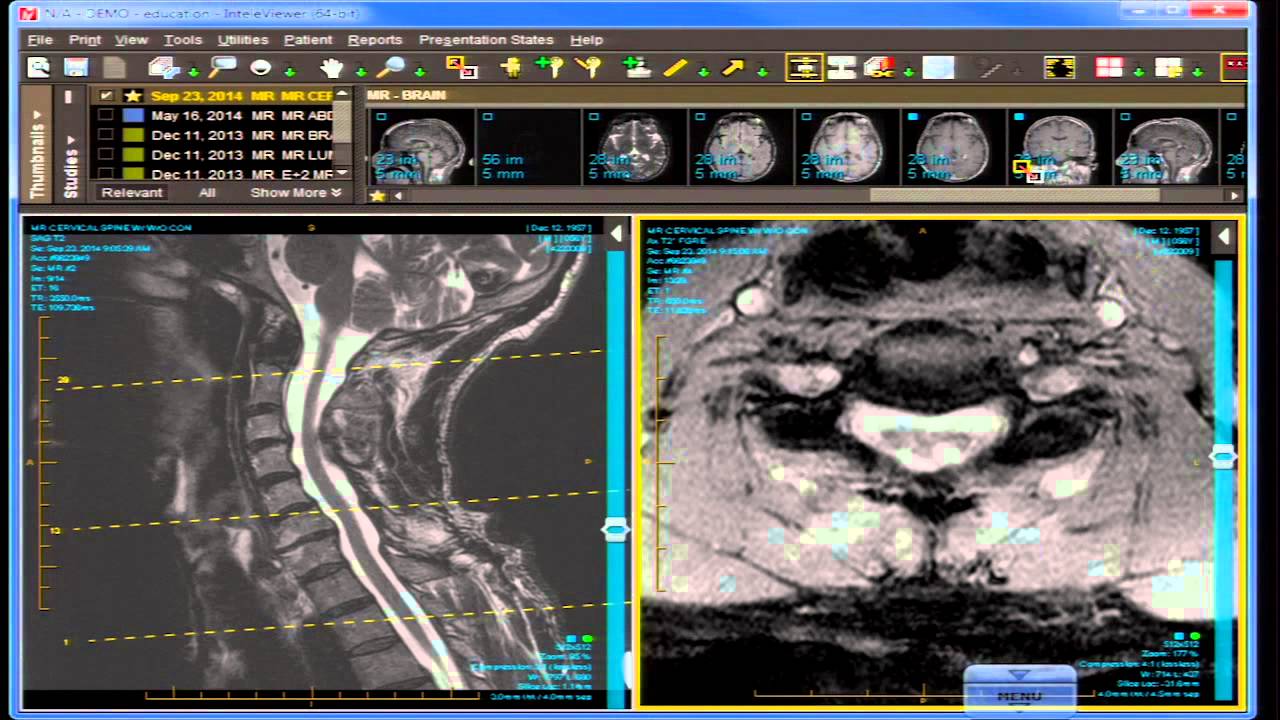 Image-Based Neurodiagnosis and Case Review