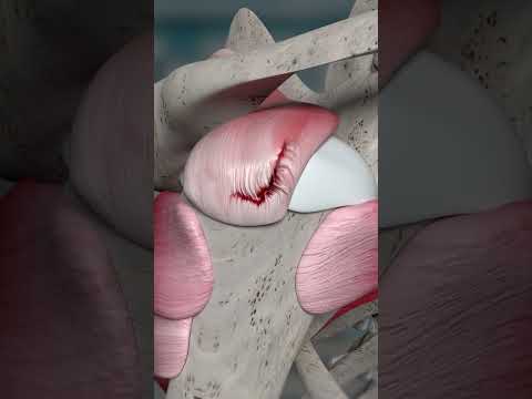 Never Ignore Shoulder Injury || Dr. Mayank Daral