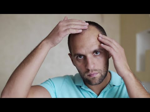 Understanding and Treating Hair Loss