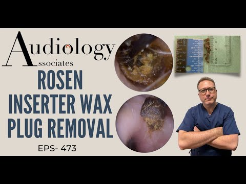 ROSEN INSERTER WAX PLUG REMOVAL - EP 473