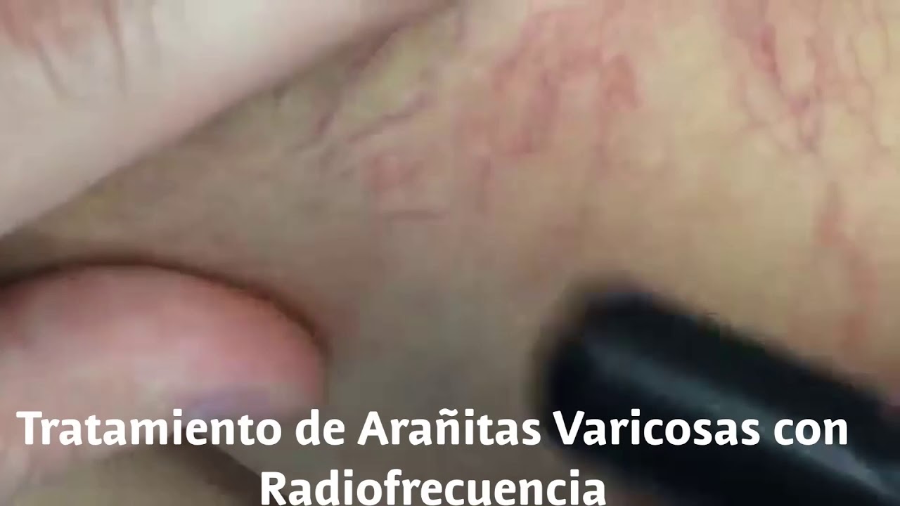 David F. Corrales Sánchez-13