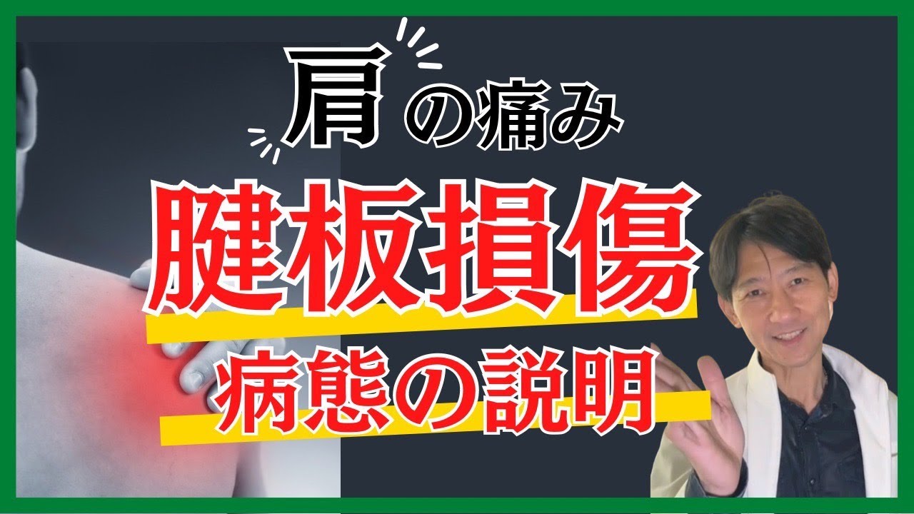 腱板損傷の保存療法について
