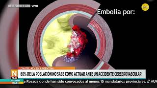 Día del ACV en la Argentina: en el país, una persona sufre 1 ACV cada 15 minutos │N7:00│ 29-10-25