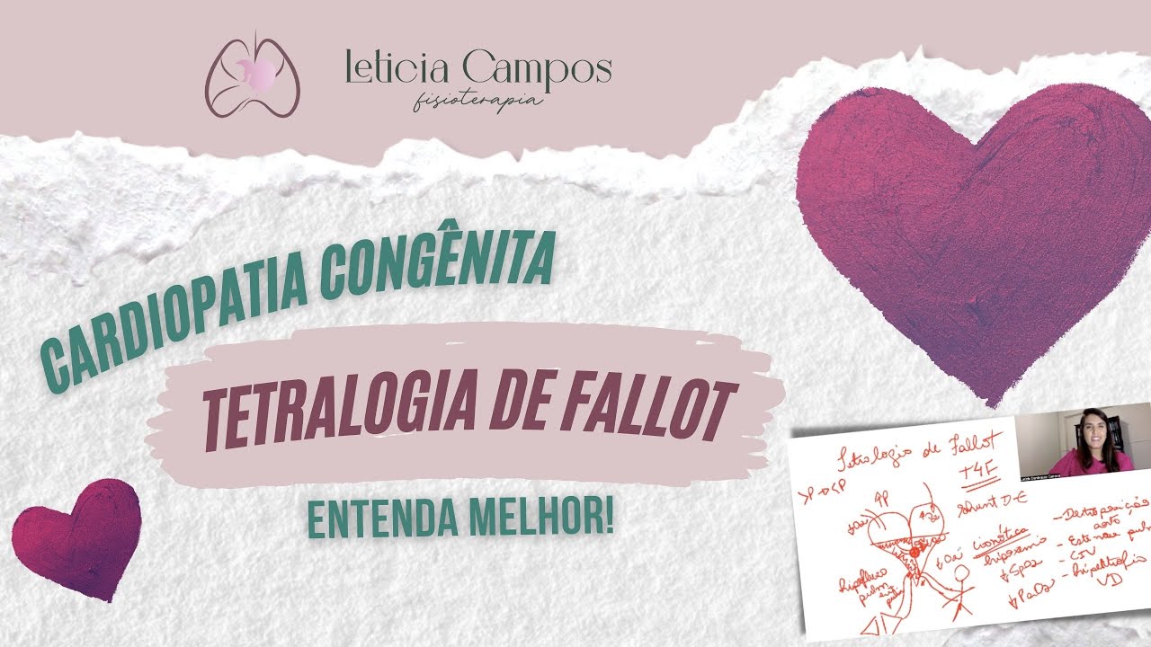 Tetralogia de Fallot: entenda melhor