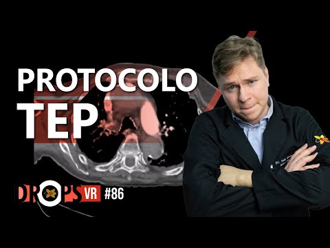 PROTOCOLO TEP  RECONHECENDO SINAIS DE INSTABILIDADE NA TC