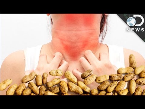 , title : '¿Por qué hay tantos alérgicos a los cacahuetes? | Discovery en Español'