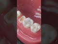 You Won T Believe How Easy It Is To Fix Your Teeth But Why Is It Always So Expensive
