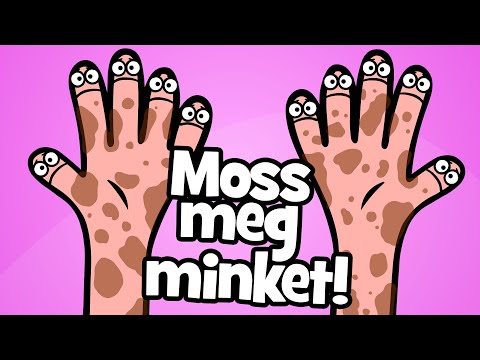 Hurrá Gyerekdalok - Moss Meg Minket!