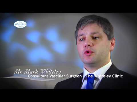 Can you treat varicose veins with support stockings and/or drugs?