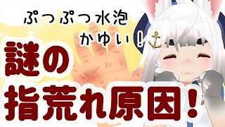謎の指荒れ原因がわかったぞ！