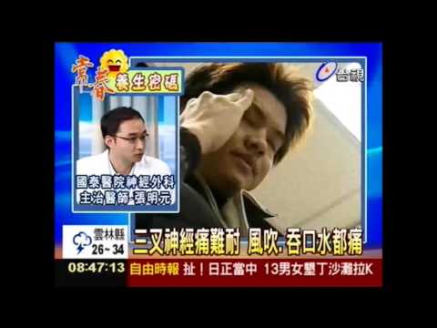 三叉神經痛 誤當牙痛當心白拔牙