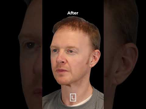 Leong Plastic Surgery NYC