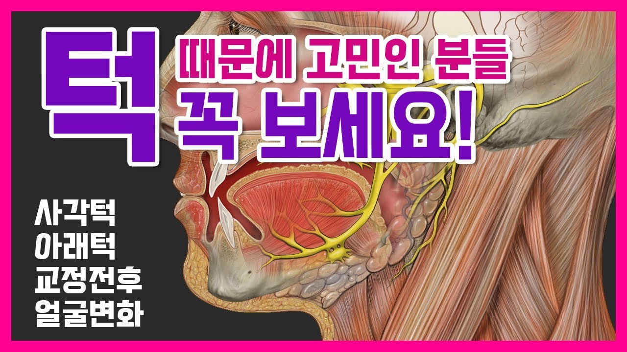 사각턱,주걱턱 얼굴형 변화 시키고 싶은 분들 보세요, 치아교정 얼굴형 교정 전후, 턱끝수술 효과, 안면윤곽수술 이유, 비수술 주걱턱교정 시기