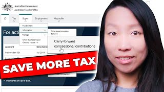 Download lagu How does Carry-forward Concessional Contribution Work? mp3 Download lagu How does Carry-forward Concessional Contribution Work? mp3