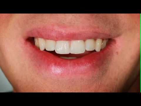 Adrian James - Visage Lifestyle Clinic Commercial