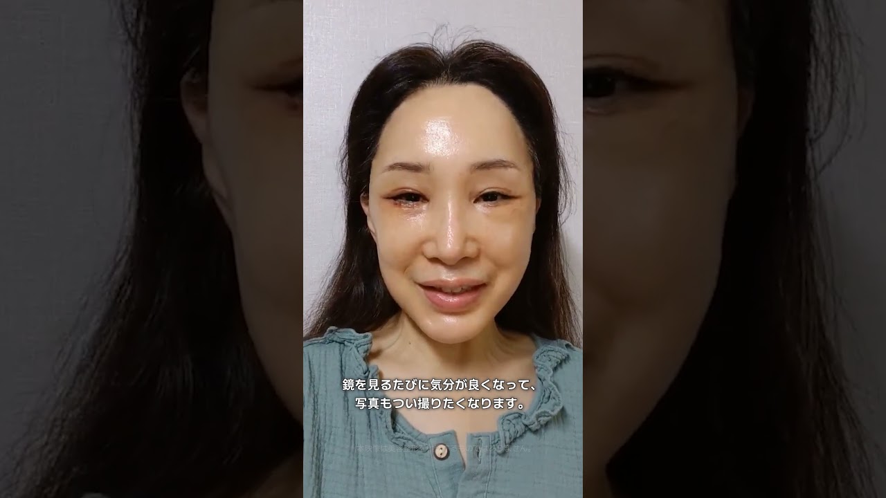 20代で女優だった50代女性…フェイスリフトでどこまで若返る？