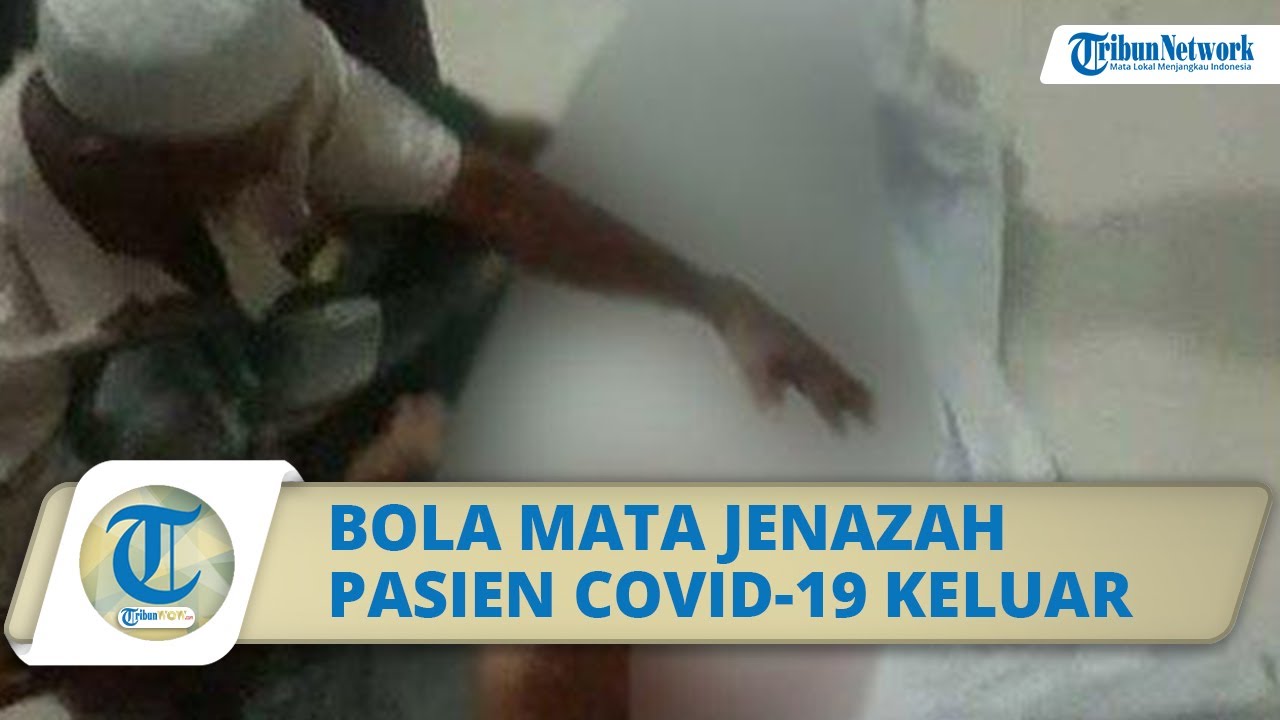 Geger Video Jenazah Pasien Covid-19 Bola Mata Keluar di Probolinggo