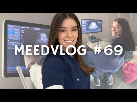 MEEDVLOG #69 - ROTINA DE UMA ESTUDANTE DE MEDICINA | ESTÁGIO DE ULTRASSONOGRAFIA