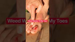 Weed Whacker VS My Bare Toes #shorts #funny #comedy