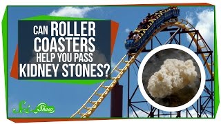 Can Roller Coasters Help You Pass Kidney Stones?