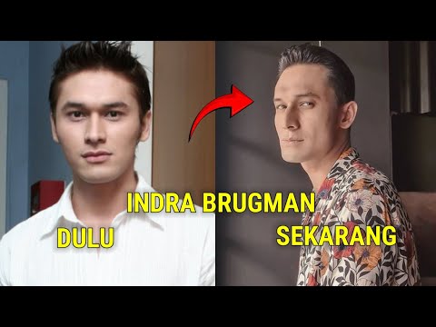Kondisi Terkini Indra Brugman Sangat mengenaskan
