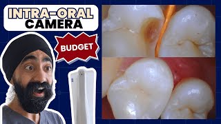 Budget Intra-Oral Camera Review: Surprisingly Good! FocusDent MD740