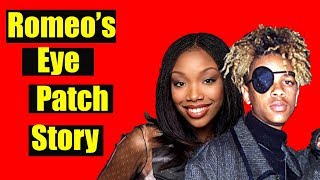 Jerome Romeo Jones Almost Losing His Eye video