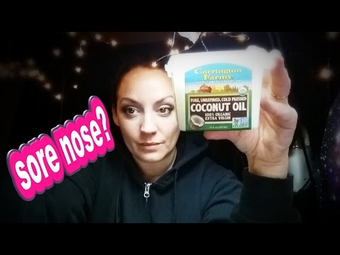Tip For Sore Nose // Vlog #23